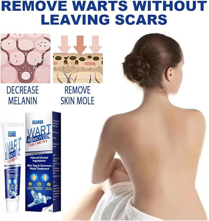 EELHOE - Wart Remover Ointment