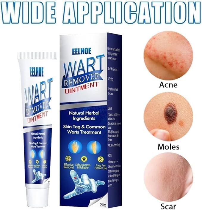 EELHOE - Wart Remover Ointment