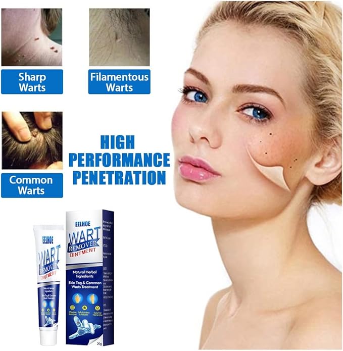 EELHOE - Wart Remover Ointment
